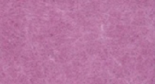 Rosy Purple